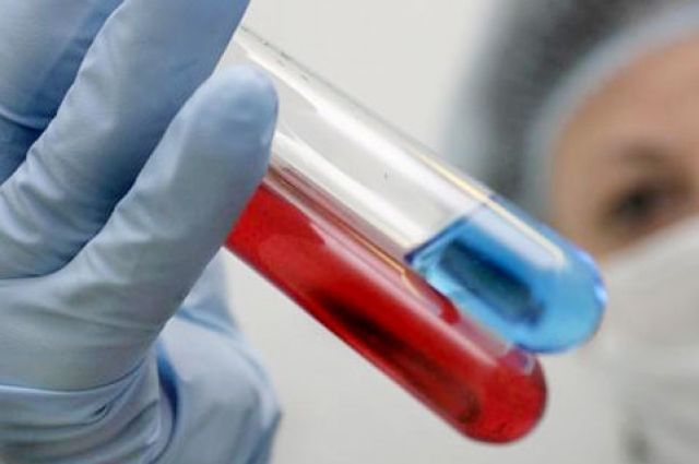Минздрав признал нехватку фармацевтических средств для лечения ВИЧ в областях