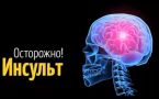 Как избежать катастрофы: 4 признака инсульта — важно вовремя их заметить