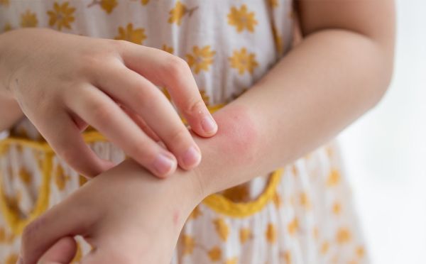 Не только аллергия: 3 неочевидные причины появления красных точек на теле