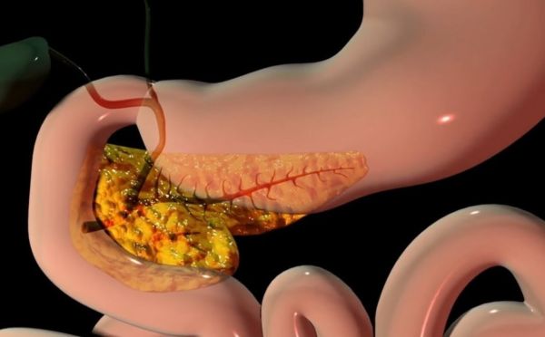 Вы сами её калечите: почему поджелудочная начинает сдавать позиции — 4 причины