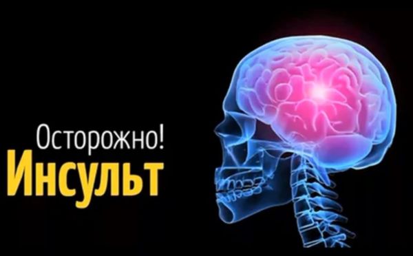 Как избежать катастрофы: 4 признака инсульта — важно вовремя их заметить