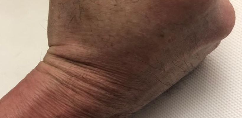 Агрессор из Нюрбинского улуса продолжает уверять, что его жена пострадала в ДТП