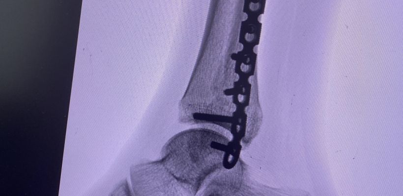 В травмпункте Якутска повторно сломался рентген-аппарат. Сроки ремонта неизвестны