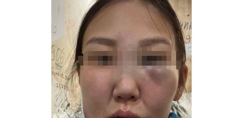 «Скажи, что любишь меня!»: Житель Якутска избил бывшую на глазах у дочери