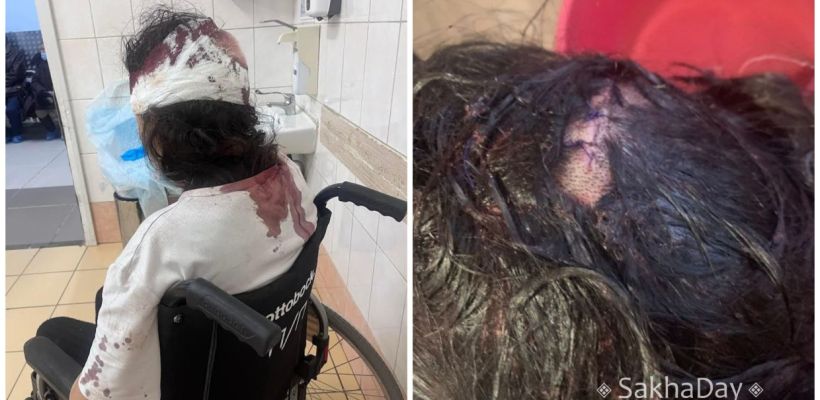«Очнулась, а он режет мне волосы»: В Якутске мужчина жестоко избил свою девушку