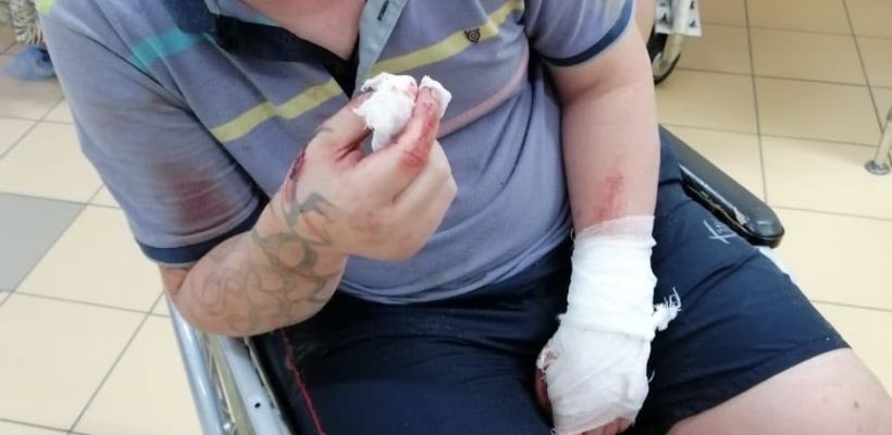 Житель Якутска 9 месяцев добивается наказания соседа, избившего его летом