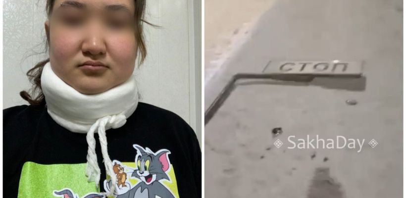 "Это сюр": В Якутске неизвестная обрушила дорожный знак на прохожую