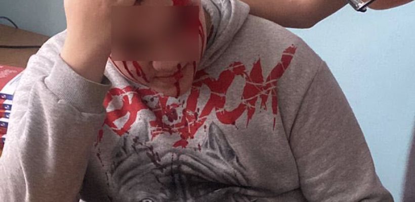 Школьнику, на которого упала плита в школе №3 в Якутске, наложили 7 швов. Родители пострадавших детей обратились в Следком