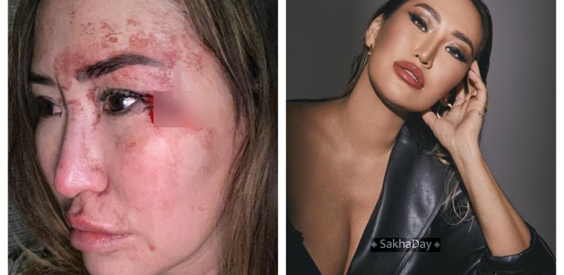 Любовь Миронова: Пример Салтанат показал нам, чем может закончиться молчание