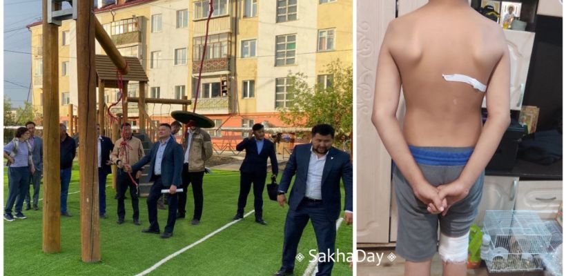 В Якутске детские площадки «Кинг-95» стали источником рваных травм второе лето подряд