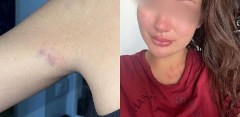 Супруга депутата Гордумы Кирилла Соболева, показавшая синяки, простила и оправдала его