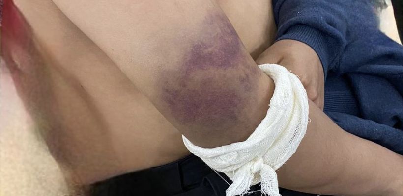 В Мохсоголлохе сотрудников кафе обвинили в нанесении побоев палкой несовершеннолетнему работнику