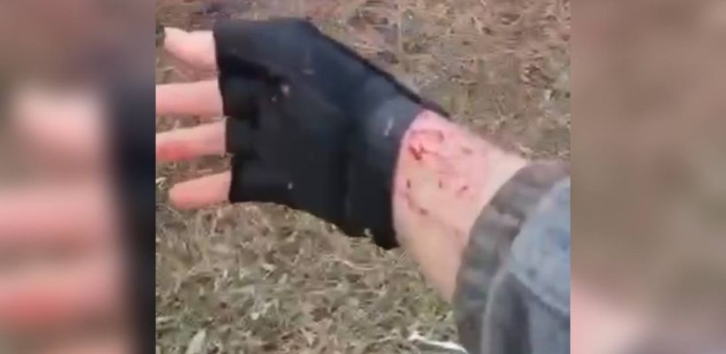 «Про снятый скальп — неправда». Старшая сестра девочки, пострадавшей от нападения собак в Чульмане, заявила о дезинформации об инциденте