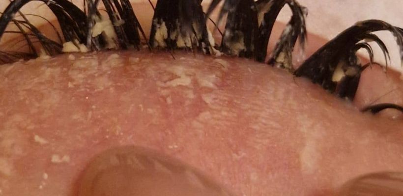 В Якутске кампания против салона Silvia beauty: у клиентки обнаружили конъюнктивит, салон отказал в бесплатном снятии ресниц