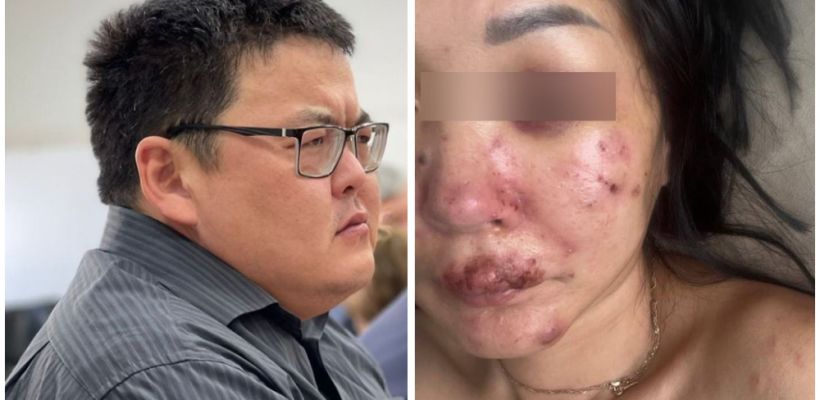 Замглавы Верхневилюйска, укусивший бывшую, отказался возмещать судебные расходы и моральный ущерб