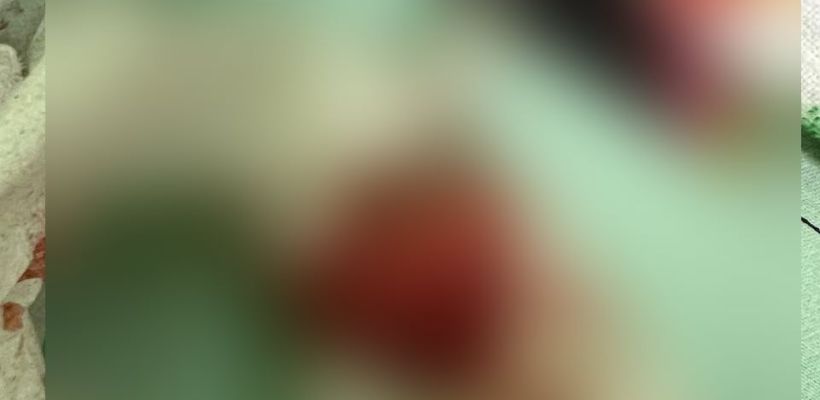 "Из меня выпал марлевый тампон". Молодую маму потрясла халатность в перинатальном центре Якутска