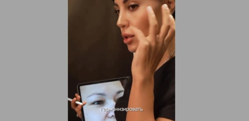 Хирург Лусине провела второй этап операции якутянке, которую изуродовал муж