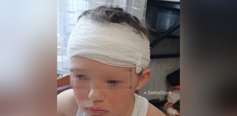 В Алдане еще не выловили покусавших ребенка собак. Будет возбуждено уголовное дело