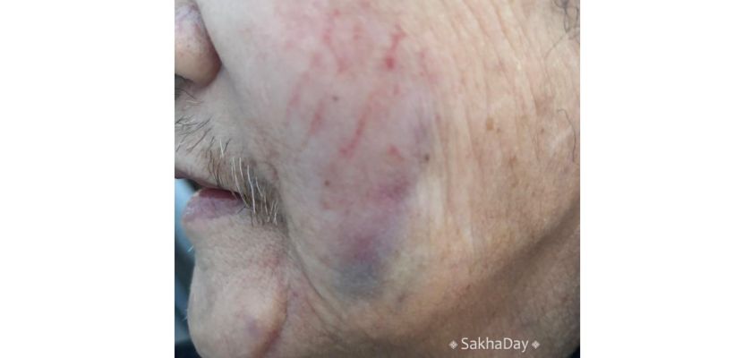 В Якутске грабитель ворвался в квартиру и избил пенсионера