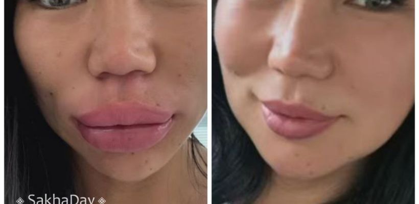 Фитнес-модель Кристина Кириллина задала тренд на натуральные губы