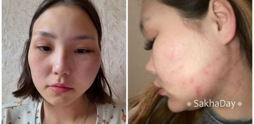 В Якутии мужчины осудили МЧСника и военного, избивавших своих девушек