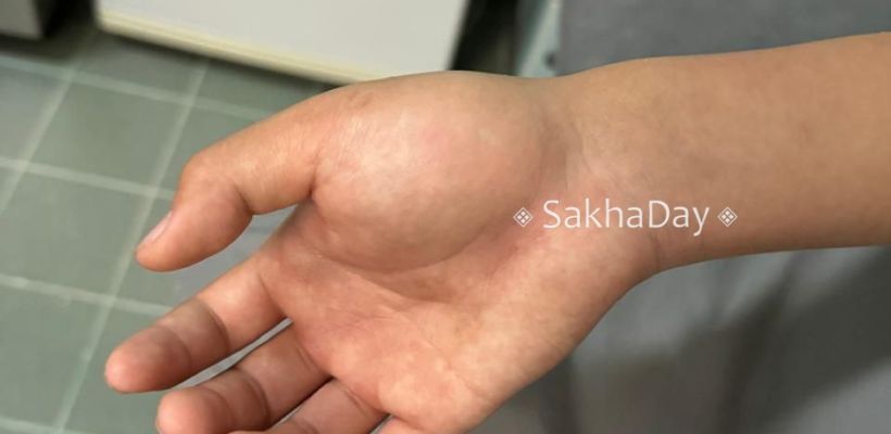 В Якутске у матери подростка, избитого сверстниками, появилась надежда на справедливость