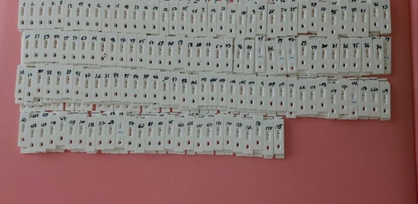 Риску заражения ВИЧ подвержены те, у кого беспорядочные половые связи