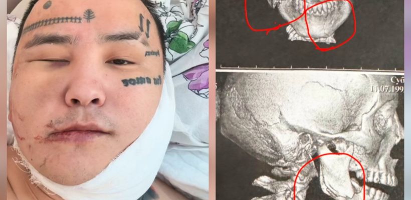 Якутского певца Kitjah пригласили выступить и жестоко избили