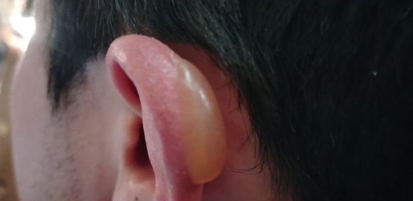 Фотофакт: Корейский экстремал отморозил в Якутии ухо