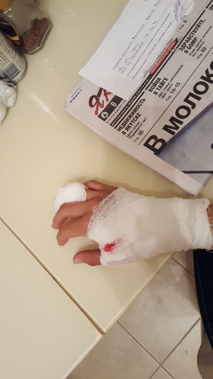 Владельцы напавших собак в Якутске извинились перед пострадавшей