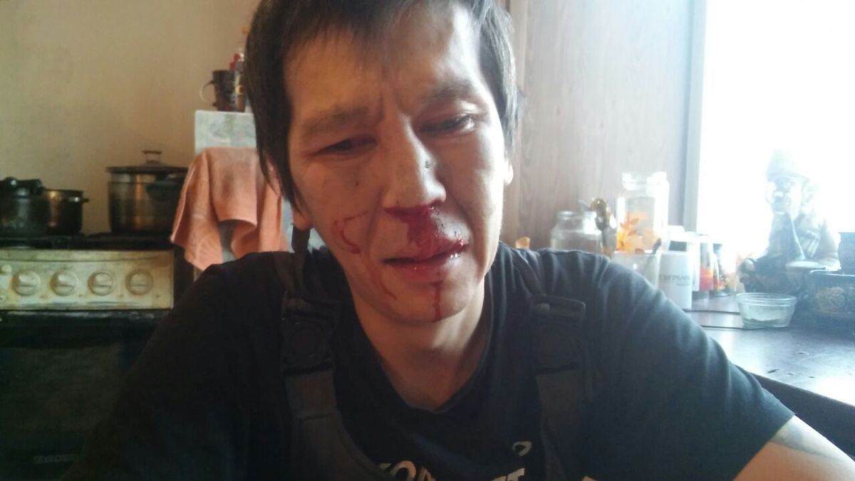 Александра ЯКНК-Захарова избили из-за трансформаторной подстанции в Якутске (видео)