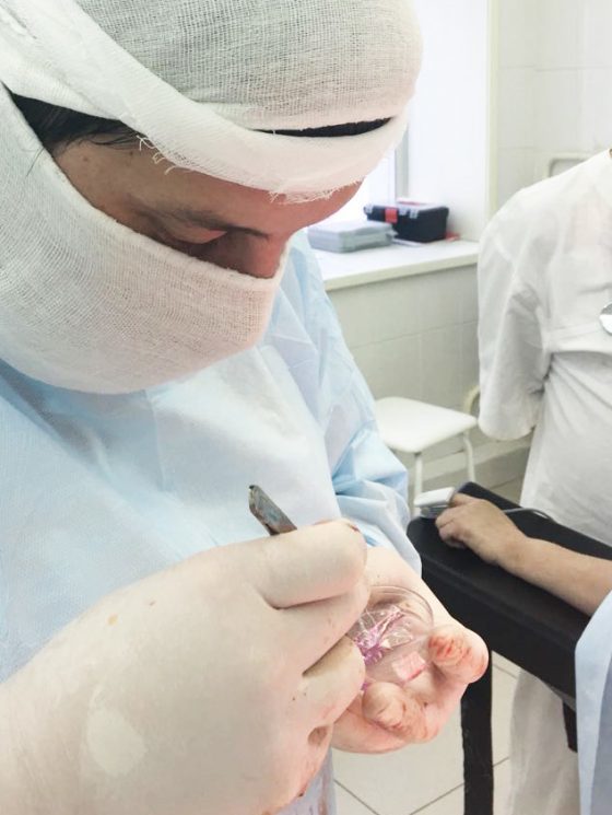 Впервые в республике: проведена операция с применением клеточных технологий