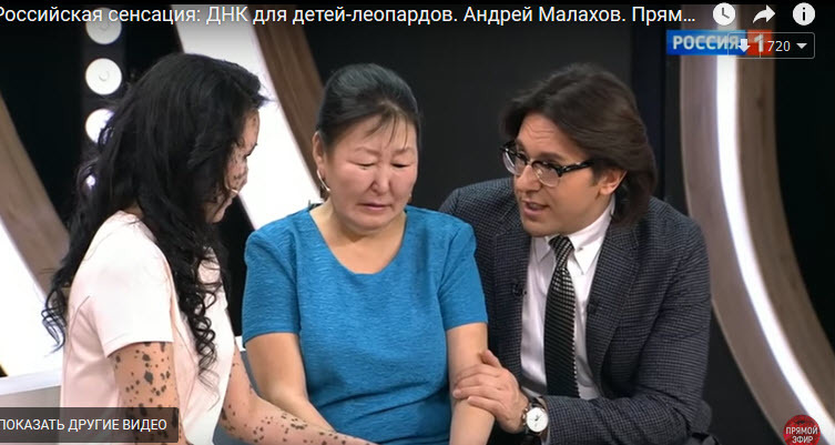 Дети-леопарды из Якутии в гостях у Андрея Малахова (+видео)