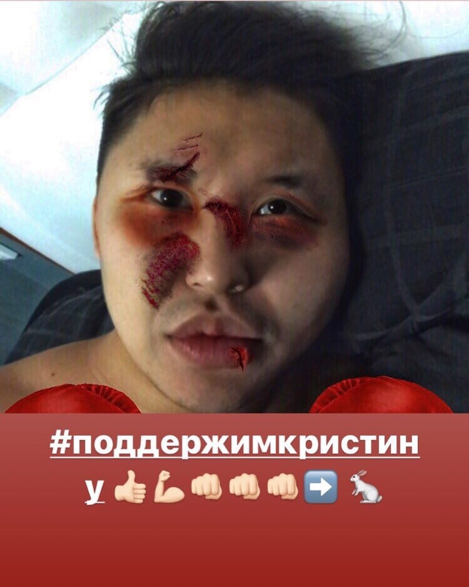 Врач-косметолог запустил хэштэг в поддержку избитой Кристины Кириллиной