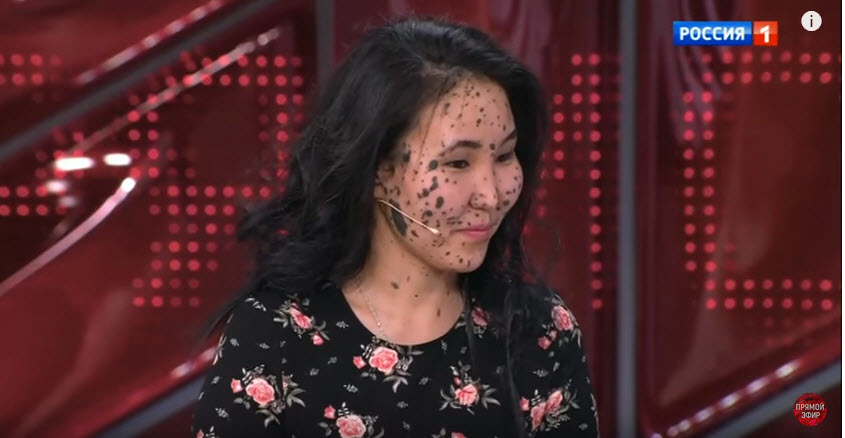 Якутская снегурочка Нарияна и девушка-леопард из Якутии еще раз встретились в студии Андрея Малахова (+видео)