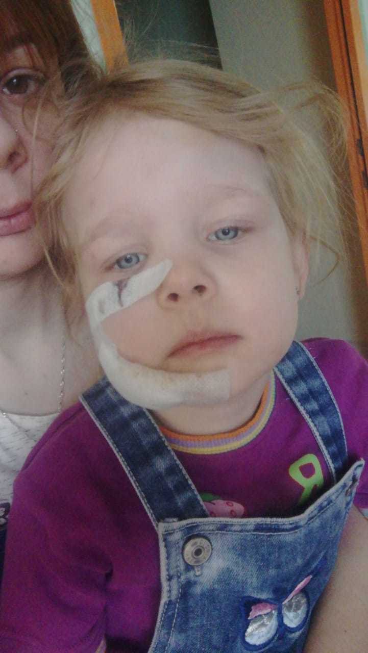 В Якутске собака искусала четырехлетнюю девочку на детской площадке