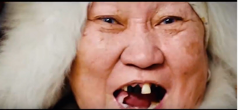 Бабушка без зубов. Ведьма с торчащим зубом. Якут в роликах.