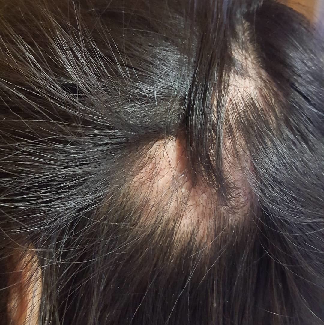 34301566_631664147184870_1048635292023521280_n