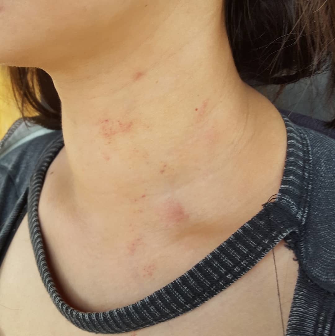 35412782_744604915930454_1918494155193974784_n