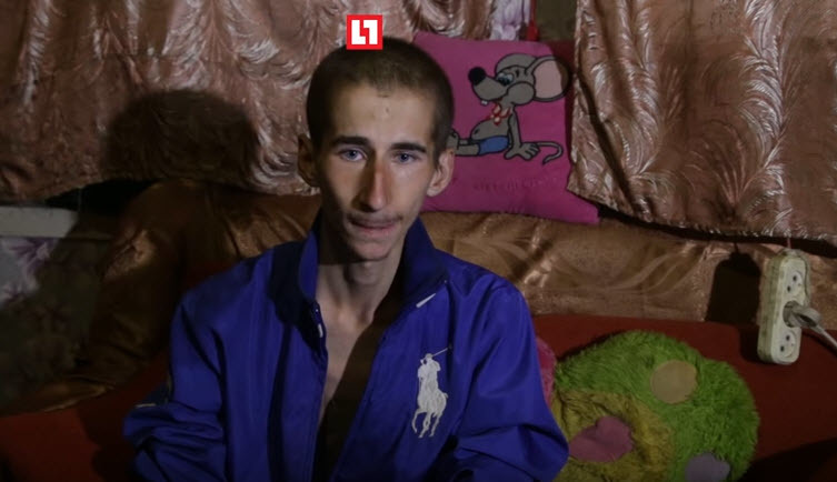 История "человека-скелета" из Якутии взволновала ростовчан (видео)