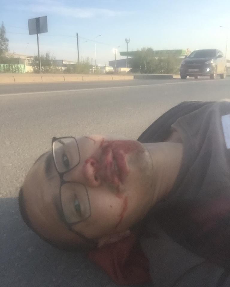 Пешеход, сделавший селфи после аварии на ДСК в Якутске, рассказал, что было потом