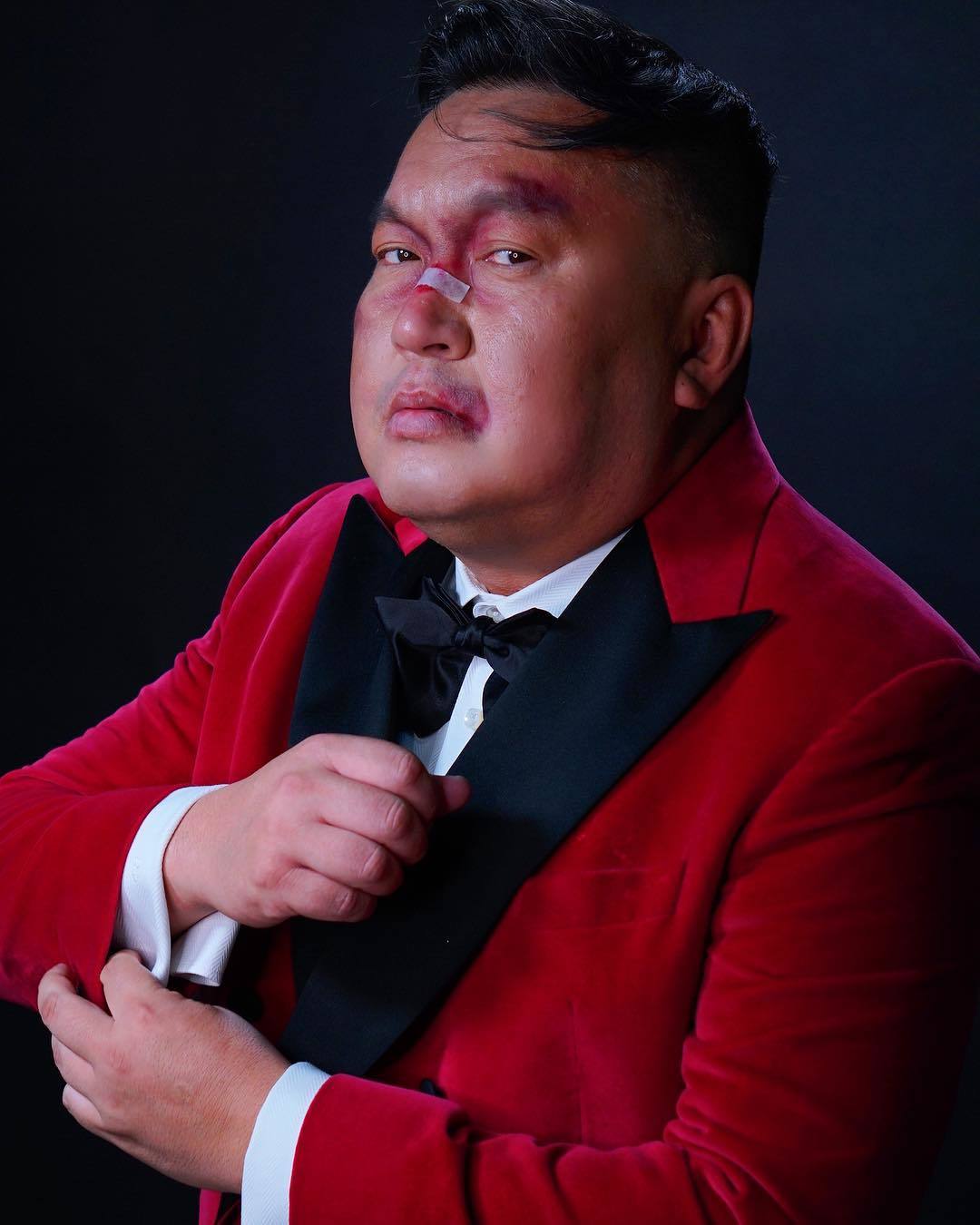 Эдик Якут опубликовал фото в поддержку избитых футболистами людей