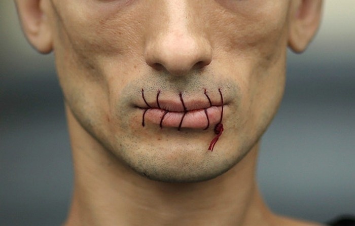 В ОНК рассказали, что в якутской ИК-1 семеро заключенных зашили себе рты