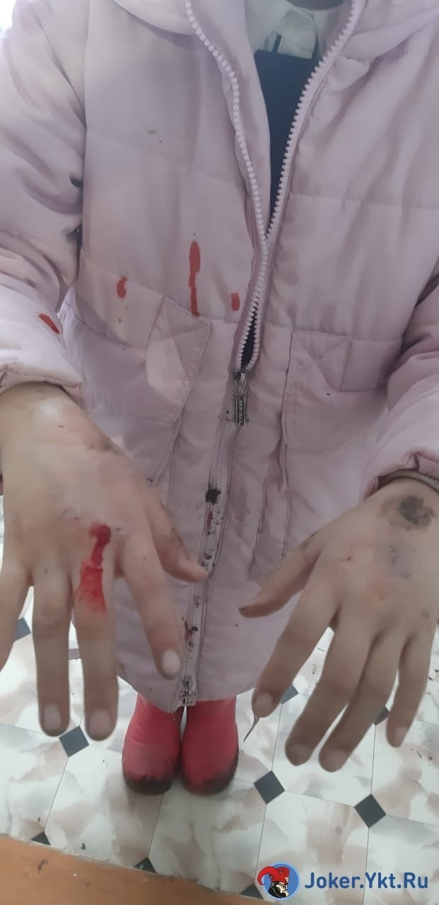 МВД: Собака покусала девочку в Нюрбинском районе Якутии