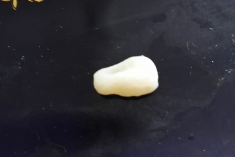 Жительница Якутска нашла в холодце местного производителя осколок кости, похожий на человеческий зуб