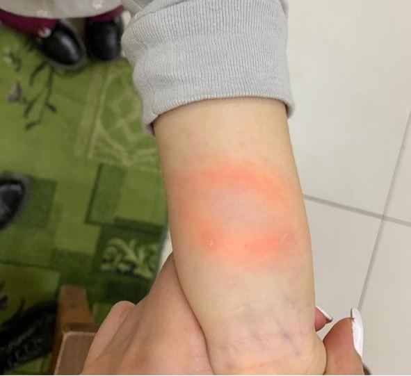 Собака укусила ребенка в контактном зоопарке Якутска