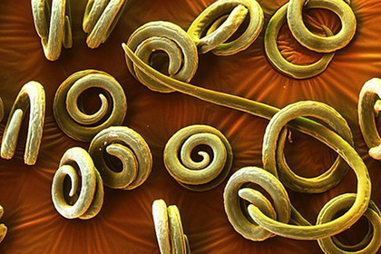 Россияне съели личинки паразитов для повышения иммунитета и попали в больницу