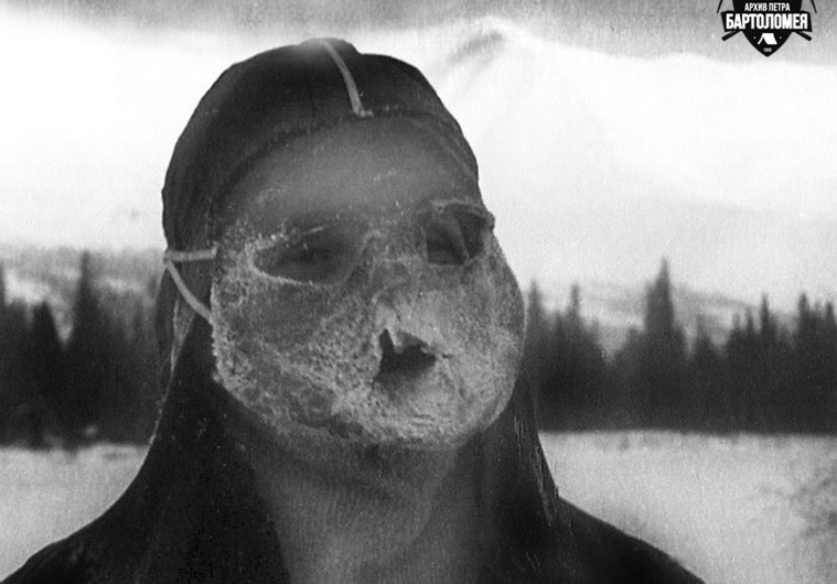 Новая версия гибели группы Дятлова: редкая северная болезнь