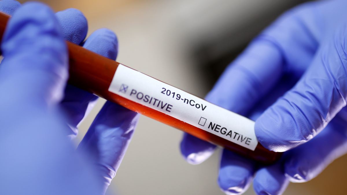 За сутки в Якутии зарегистрировано 30 новых случаев коронавируса