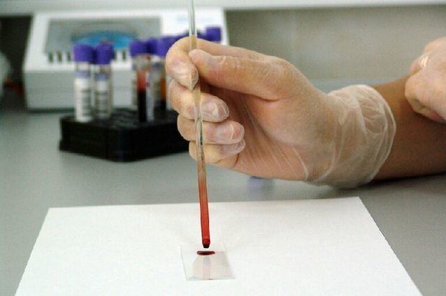 В Якутии за сутки зарегистрировано 33 новых случаев коронавируса